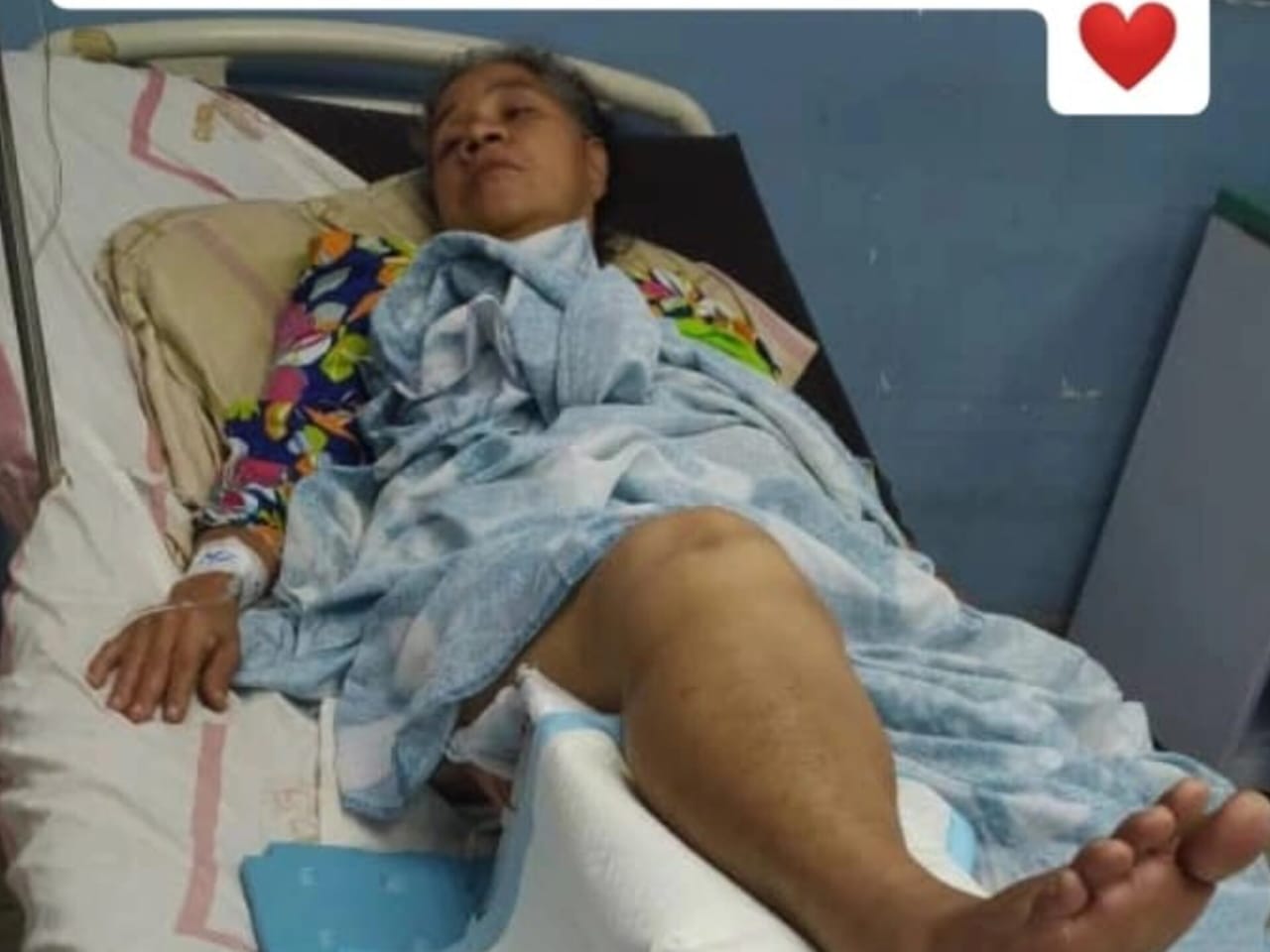 La señora Magalis Mejía se fracturó una rodilla y está hospitalizada: Requiere ayuda económica