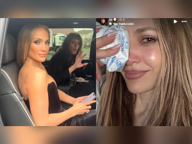 Jennifer López aparece con su rostro golpeado y preocupa a sus seguidores