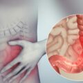 Cada 19 de mayo, se conmemora el Día Mundial de la Enfermedad Inflamatoria Intestinal