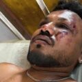 Hay un sobreviviente dentro del Boeing siniestrado en la India