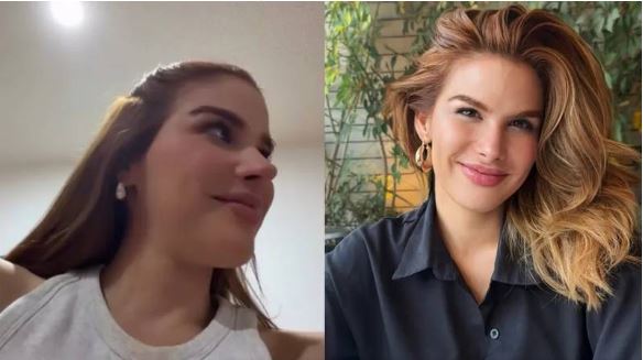 Marie Claire Harp transformó su imagen: Se operó la nariz